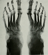 Photo: x-ray of a human foot